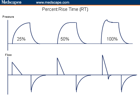 Figure 2: Changes in peak flow at various rise time settings.