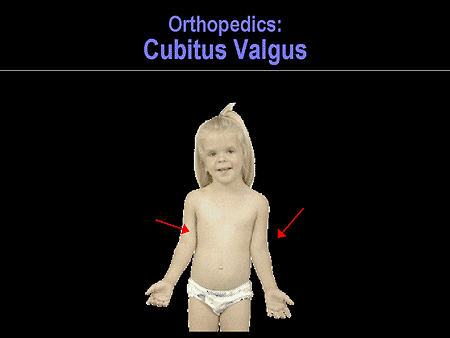 http://images.medscape.com/pi/editorial/cmecircle/2002/2155/slide29.gif