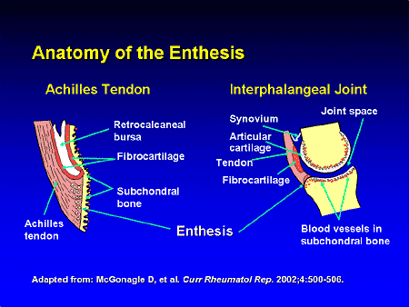 http://images.medscape.com/pi/editorial/cmecircle/2004/2890/images/slide13.gif