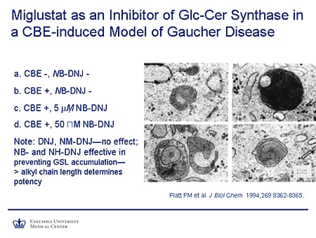 Miglustat as an Inhibitor of Glc-Cer Synthase in a CBE-Induced Model of Gaucher Disease