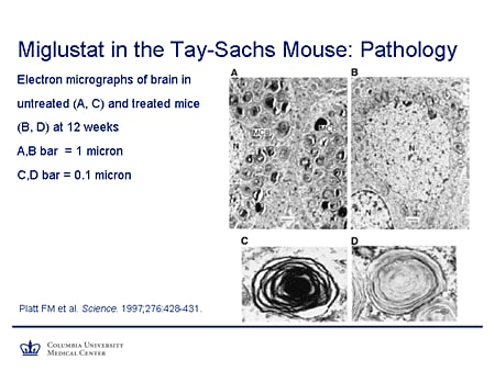 Miglustat in the Tay-Sachs Mouse: Pathology