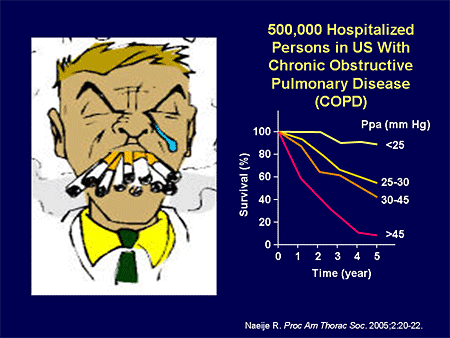 500,000 Hospitalized Persons in US With Chronic Obstructive Pulmonary Disease (COPD)