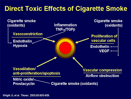 Direct Toxic Effects of Cigarette Smoke