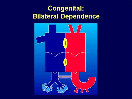 Congenital: Bilateral Dependence