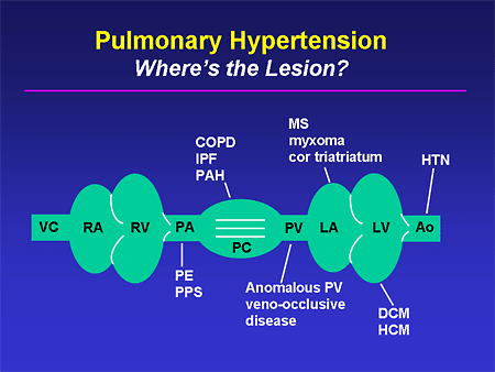 Pulmonary Hypertension: Where's the Lesion?
