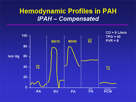 Hemodynamic Profiles in PAH: IPAH -- Compensated