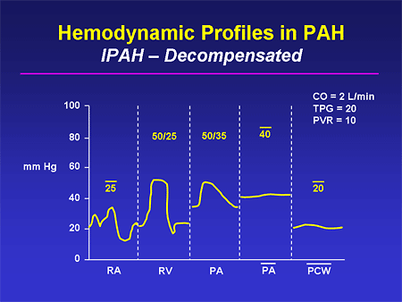 Hemodynamic Profiles in PAH: IPAH -- Decompensated