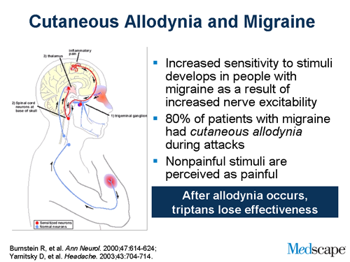 Slide 7.