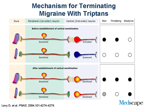 Diagnostic and Therapeutic Challenges of Acute Migraine