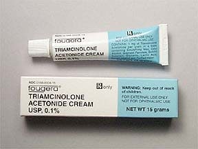 Corticosteroid ointment for mouth