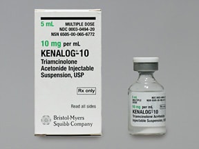 Intralesional steroid treatment