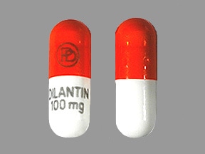 phenytoin sodium