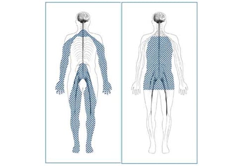 Diabetic neuropathy affects